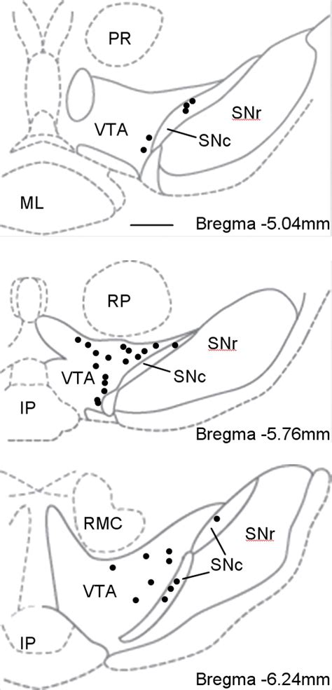 Dopamine Signaling Differences In The Nucleus Accumbens And Dorsal