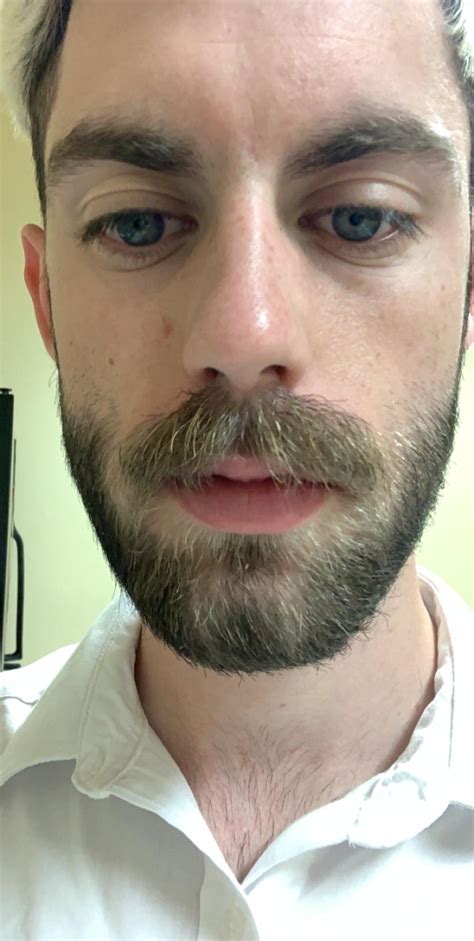 Keep Stache Over Top Lip Moustache