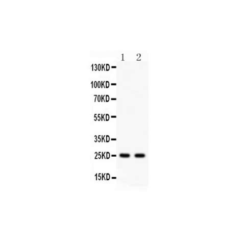 raba antibody novatein biosciences