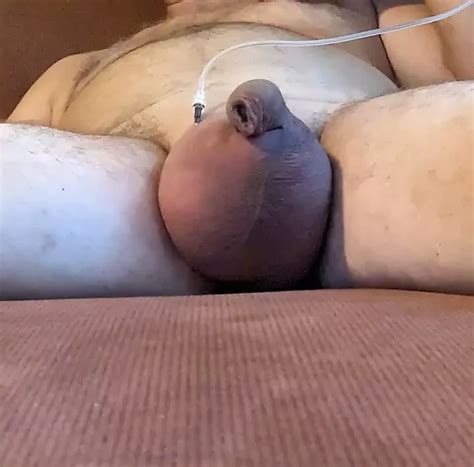 Saline Glucose Timelaps Gay Vintage Amateur Porn XHamster