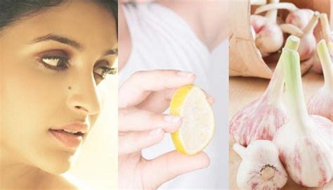 8 Easy Home Remedies For Quick Removal Of Skin Tags