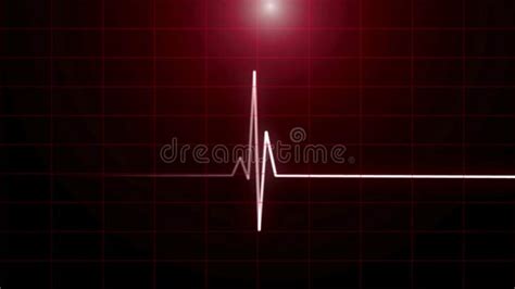 Cardiac Arrest on the Medical Monitor, Heart Stops Beating. Stock ...