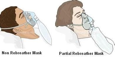 Applying A Nasal Cannula Or Oxygen Mask Flashcards Quizlet