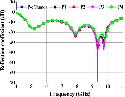 Figure From Localization Of Breast Tumor Using Four Elements Uwb