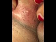 Satisfying Pimple Popping On My Pussy Xxx Mobile Porno Videos Movies IPornTV Net