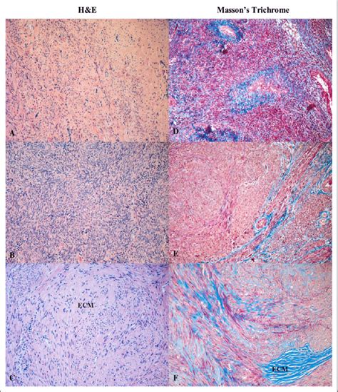 Hematoxylin Eosin And Masson S Trichrome Stained Sections Of Human