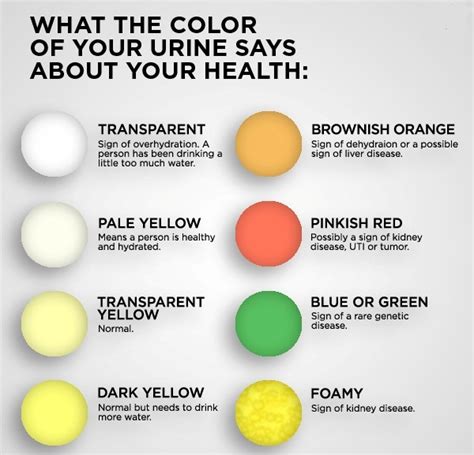 LOOK: The Color Of Your Urine Tells About Your Health