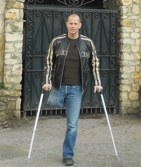 Yesomex Dickreadyamputees Watch Free Gay Amputee Videos