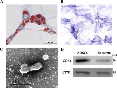 Exosomes Derived From Mmu Circ Modified Adipose Derived