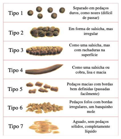 Tipos De Constipação Intestinal