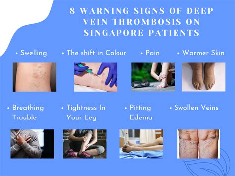 8 Warning Signs of Deep Vein Thrombosis on Singapore Patients - 100% Health