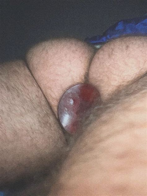 Chunky Ass Cheeks Nude Pics Xhamster