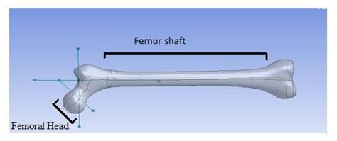 Femoral Head and femur shaft. | Download Scientific Diagram