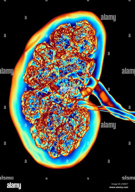 Kidney Ct Scan False Colour 3 D Computed Tomography Ct Scan Of A