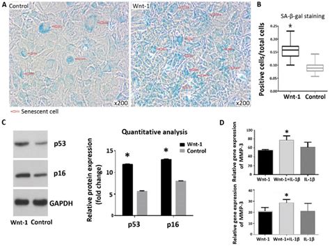 Wnt Induces Senescence In Chondrocytes A Sa Gal Staining Of The