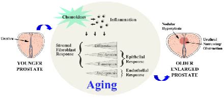 Figure 1 from Chemokines and BPH/LUTS. | Semantic Scholar