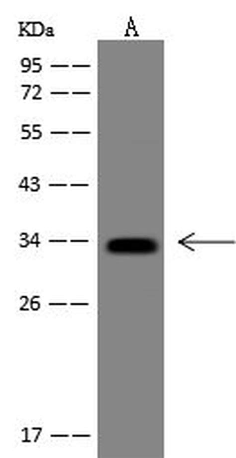 Flagellin Monoclonal Antibody 06 Ma5 28968
