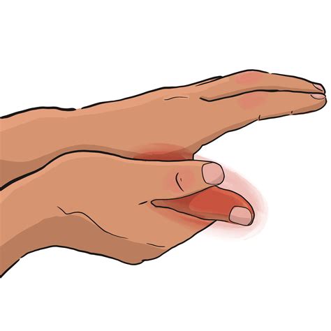 Thumb spasming could be a sign of a serious nerve condition 15
