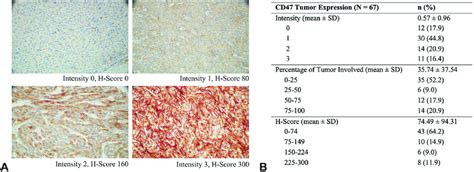 CD47 Expression In Thymic Epithelial Tumors A Representative