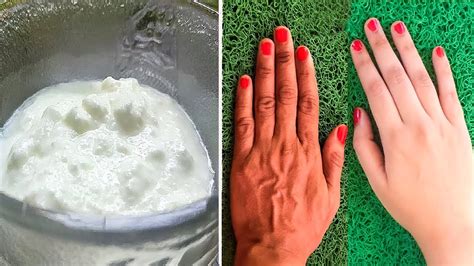 Как отбелить Кожу Рук и Лица за 15 мин! Супер способ может сделать ...