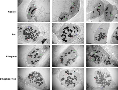 Transmission Electron Microscopic Tem Images Show The Plastid