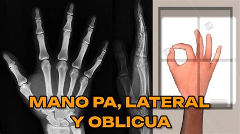 RadiografÍa De Mano Pa Lateral Y Oblicua Manual De Bolsillo 8 Youtube