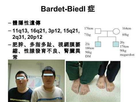 20180418 bardet biedl syndrome