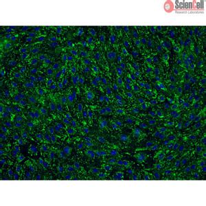 Human Cervical Microvascular Endothelial Cells From Sciencell Research