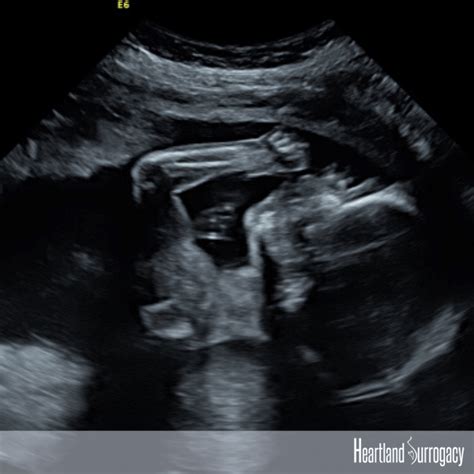 LGBTQ Surrogacy Stories Gay Dads Promoting Surrogacy Heartland Surrogacy