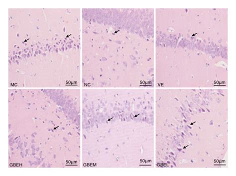 Effects of EGb761 on histopathological and ultrastructural changes in ... 