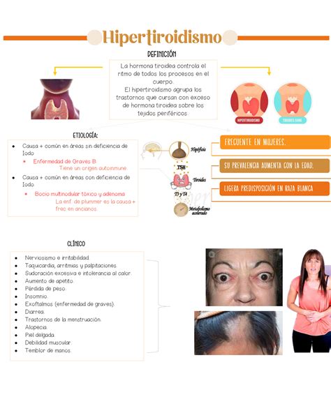 Hipertiroidismo Mapa Conceptual Definicin La Hormona Tiroidea The