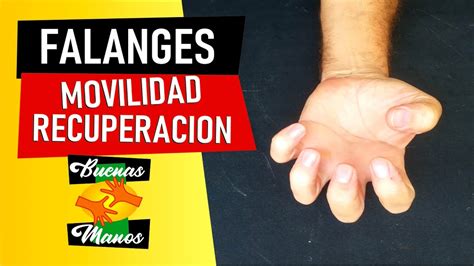 Rehabilitaci N De Falanges Ejercicios Para Los Dedos De Las Manos