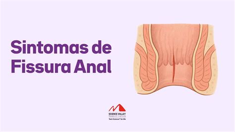 Sintomas De Fissura Anal Quando Se Preocupar Science Valley