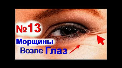 Гусиные лапки - морщины вокруг глаз | Маска от морщин под глазами - YouTube