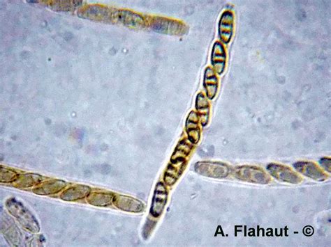 Micromycète ascomycète Lentomitella cirrhosa A Flahaut