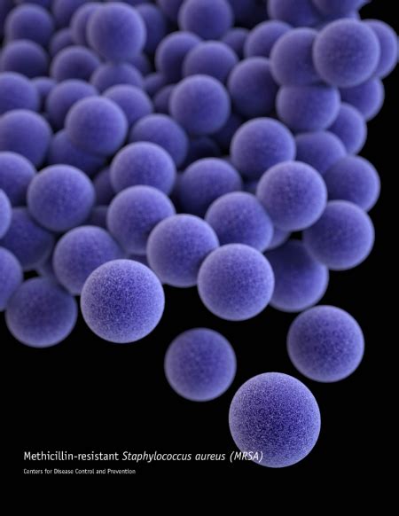 Staphylococcus Aureus Methicillin Resistant Invasive Disease