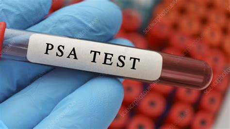 Prostate Specific Antigen Test Conceptual Image Stock Image F036