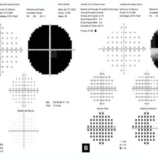 A Campo Visual Do Od Apresentando Escotoma Absoluto B Campo