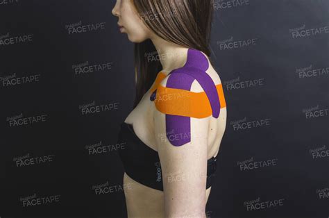 Тейпирование плеча | Статьи о тейпировании