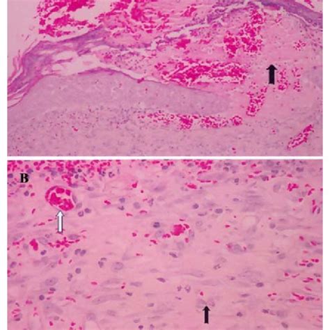 Photomicrograph H E Of Histological Skin Cuts In Wistar Rats Control