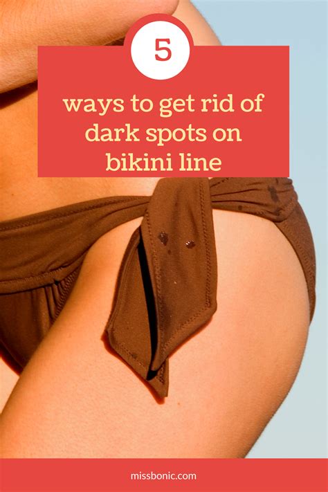Dark Spots On Bikini Line At Melody Hanks Blog