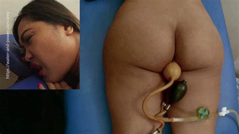 Amy Bag Fill Enema Part British Anal Anal Porn By Water And Power Xhamster