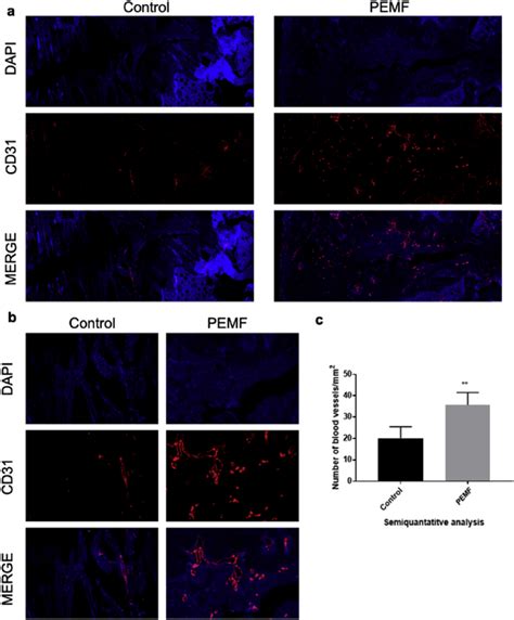 Immunofluorescence Staining And Semi Quantitative Analysis Of Cd At