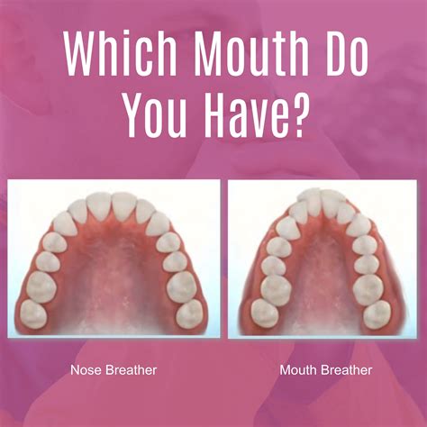 face of a mouth breather