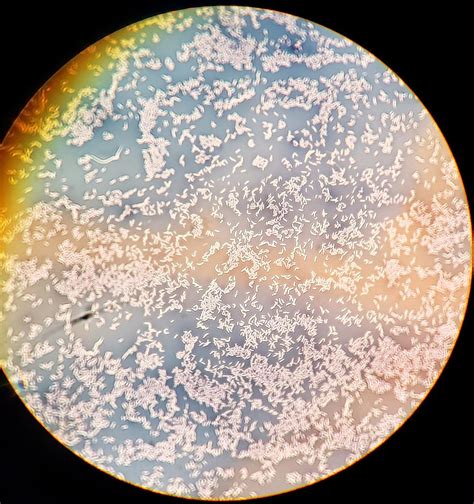 My Capsule Stain Of Bacteria At 1000x Total Magnification Rmicrobiology