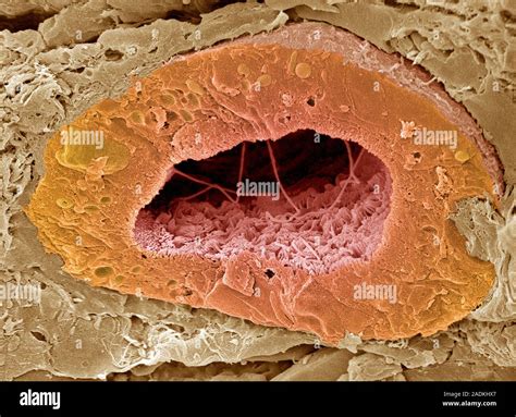 Kidney Tubule Coloured Scanning Electron Micrograph Sem Of A