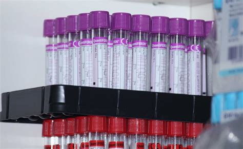sample preparation  transport red labs
