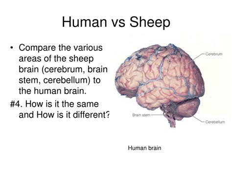 Ppt Sheep Brain Dissection Guide Powerpoint Presentation Free Download Id 269336