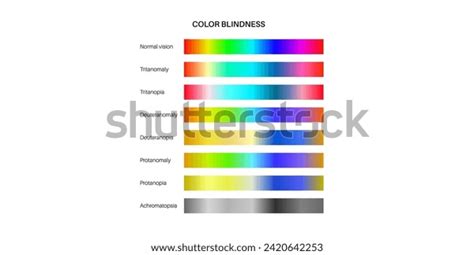 Color Blindness Infographic Vision Deficiency Concept Stock Vector ...