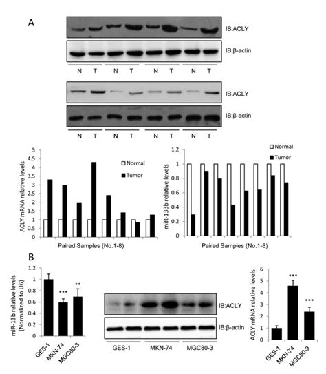 Mir 133b Acts As A Tumor Suppressor And Negatively Regulates Atp